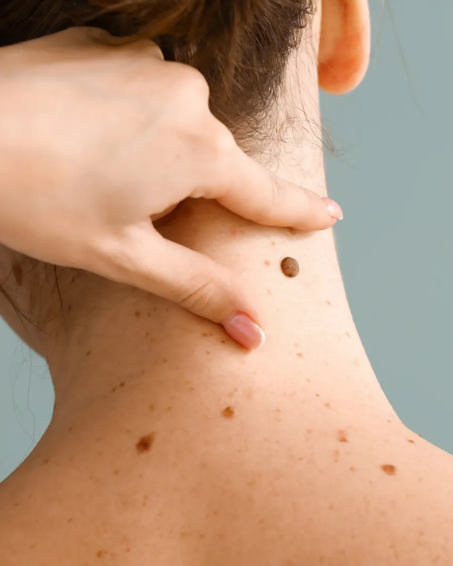 Advanced Skin Evaluation at Cinch Clinics
